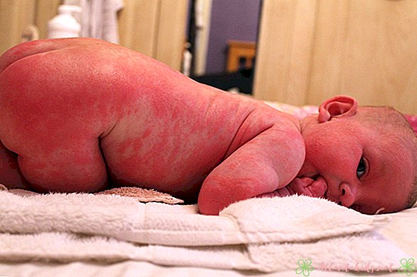 Bendrosios kūdikių odos sąlygos