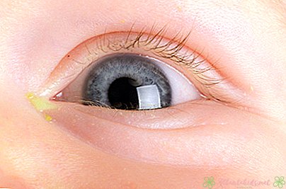 Novorojenčevo izpuščanje oči: vzroki in zdravljenje - nov otroški center