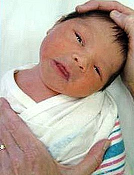 Torticollis Baby: Симптоми, причини и лечение - Нов детски център