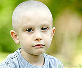 Tanda Leukemia pada Anak - Pusat Anak Baru