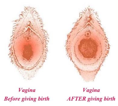 Problemi durante il recupero della nascita vaginale e cosa fare