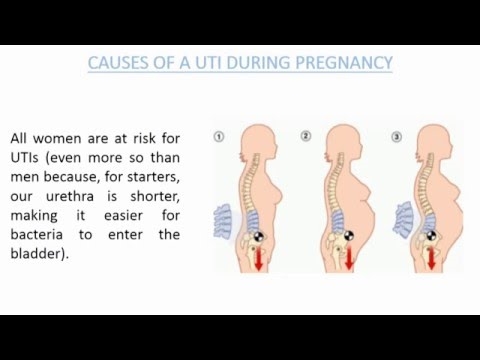 Příčiny UTI v těhotenství