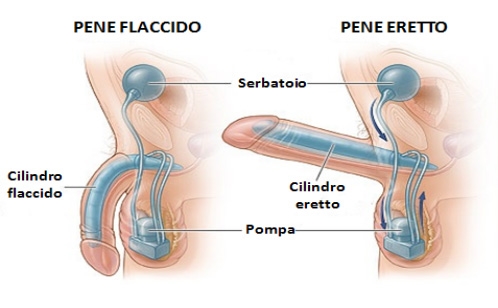 Cosa causa un clitoride gonfio?