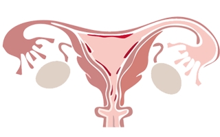 Endometriozis Hakkında Bilmeniz Gerekenler?