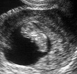 Test durante la gravidanza - New Kids Center