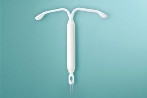 דימום כבד וסיבוכים אחרים עם IUD