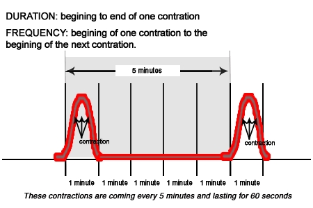 Какво означава да има контракции 10 минути?