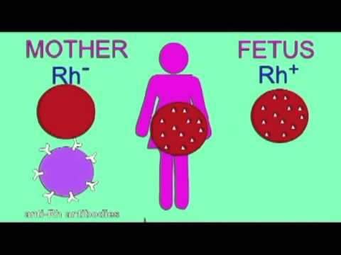 Zijn er veiligheidsproblemen tussen Rh Negative en Zwangerschap?