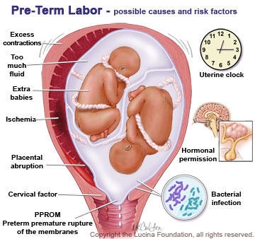 ¿Cuáles son los posibles problemas de salud para los bebés prematuros?