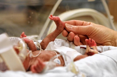 Mitkä ovat mahdolliset terveyskysymykset ennenaikaisille vauvoille?