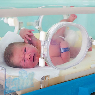 Apa Kemungkinan Masalah Kesehatan untuk Bayi Prematur?