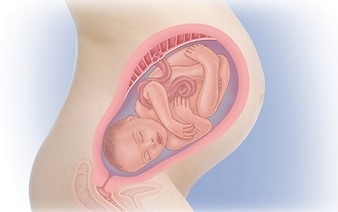 Wodurch werden 34 Wochen schwangerer Krampf verursacht?