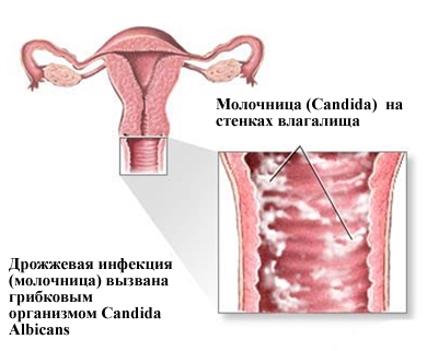 Различные типы вагинальных выделений и их значение