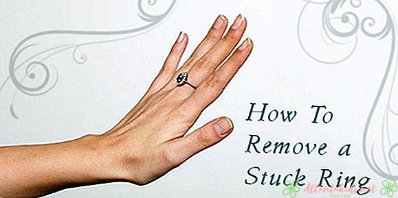 Inelul Stuck pe degetul tau umflat? 5 moduri care funcționează! - Noul centru pentru copii