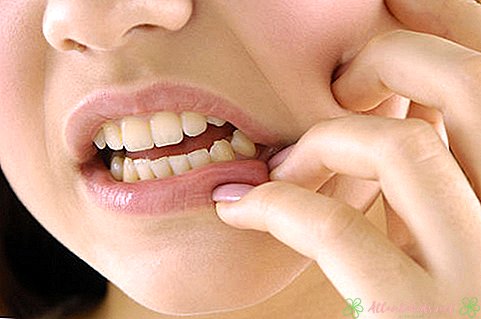 影響を受ける知恵の歯の症状