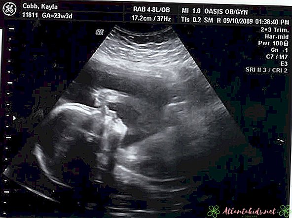 Kaj lahko pričakujete pri ultrazvoku pri 23-tedenski nosečnosti - nov otroški center