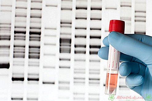 DNA-Test während der Schwangerschaft - New Kids Center