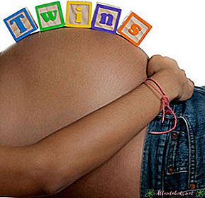 8 דברים שכדאי לדעת על הריון תאומים