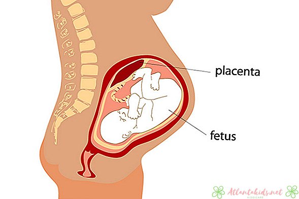 Komplikācijas, kas var ietekmēt Placenta