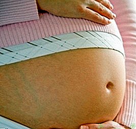 38 tednov noseča - nov otroški center
