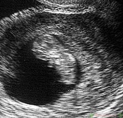 Ko tikėtis su ultragarsu 7 savaitės nėštumo metu? - Naujas vaikų centras