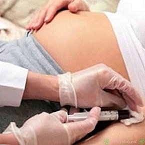 Sladkorna raven med nosečnostjo, kaj je normalno? - Novi center za otroke