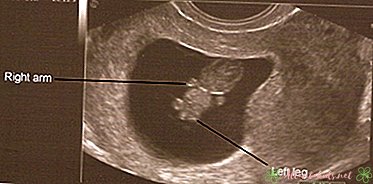 Ultrazvuk v 8 týždňoch: Čo môžete očakávať - ​​Nové detské centrum