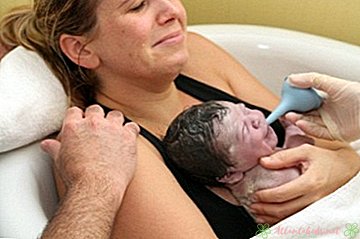 Prirodzené narodenie oproti epidurálnemu prehľadu