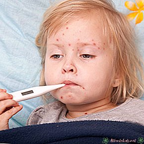 Meningitis pada Balita - Pusat Anak Baru